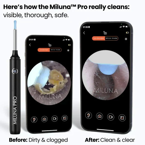 EAR WAX CLEANER